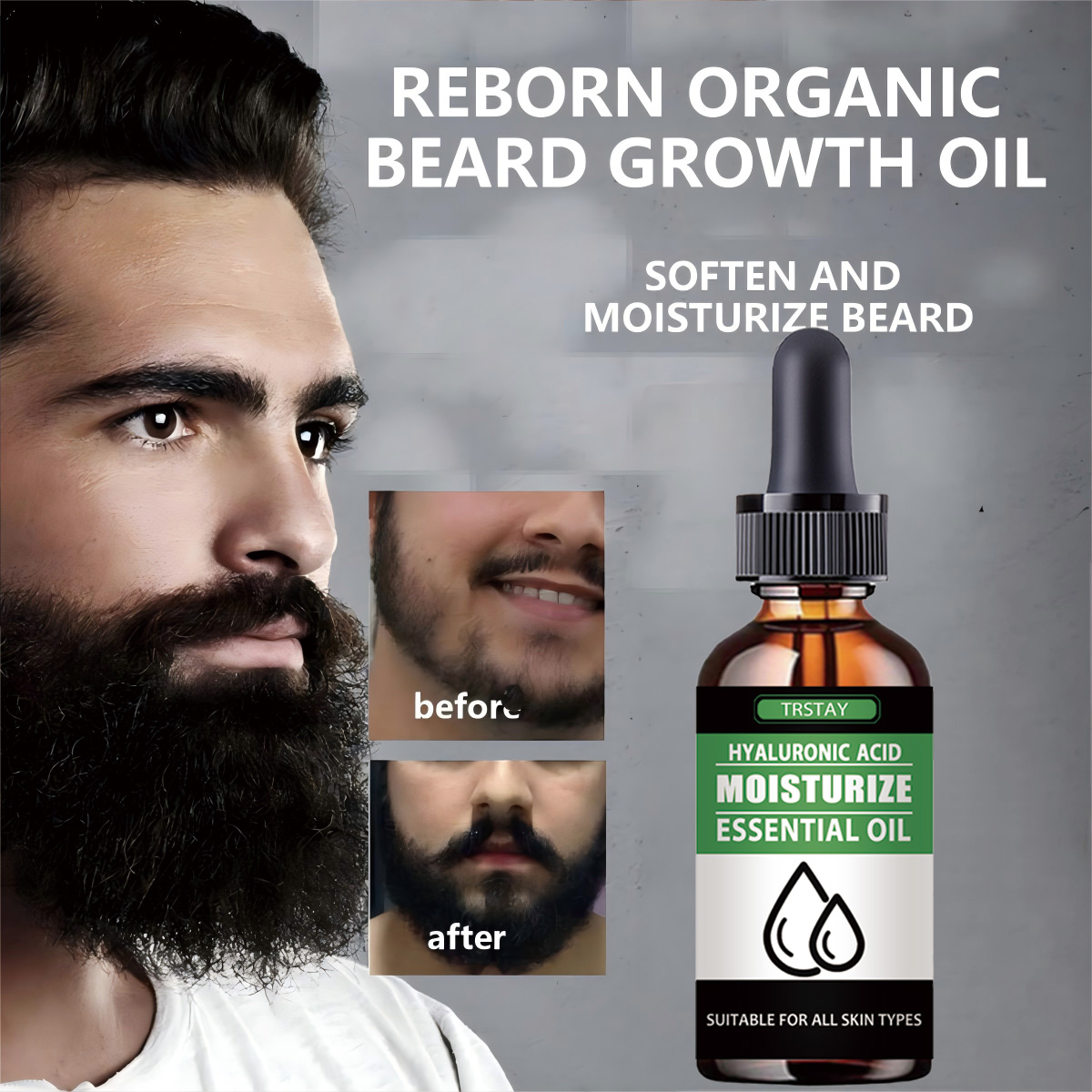 Men'S Grooming And Skin Care - 100% ธรรมชาติเร่งผมบนใบหน้า Grow Beard Essential Oil