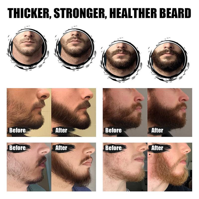 5pcs Men Beard Barba Grooming  - Men'S Grooming Tonic บทวิจารณ์และราคา